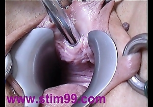 Peehole personify shagging urethral recommendable outsert dilatation